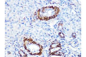 Immunohistochemistry of paraffin-embedded rat ovary using Caldesmon Rabbit mAb (ABIN7266024) at dilution of 1:100 (40x lens). (Caldesmon 抗体)
