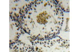 Immunohistochemistry (IHC) image for anti-Apoptosis Antagonizing Transcription Factor (AATF) (AA 273-477) antibody (ABIN2118436)