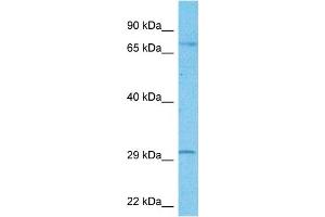 Host:  Rabbit  Target Name:  FOXR2  Sample Type:  U937 Whole Cell lysates  Antibody Dilution:  1. (FOXR2 抗体  (Middle Region))