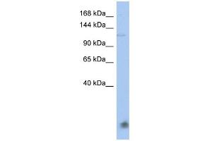 WB Suggested Anti-HERC5 Antibody Titration:  0.