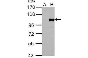 WB Image FOXM1 antibody detects FOXM1 protein by Western blot analysis. (FOXM1 抗体)