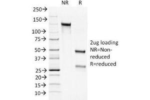 SDS-PAGE Analysis of Purified, BSA-Free Bcl2 Antibody cocktail (100/D5 + 124). (Bcl-2 抗体  (AA 41-54))