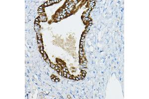 Immunohistochemistry of paraffin-embedded Human hepatobiliary duct using IR Rabbit pAb (ABIN6130499, ABIN6142522, ABIN6142523 and ABIN6221797) at dilution of 1:50 (40x lens). (IRAK4 抗体  (AA 1-220))