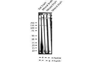 Western blot analysis of Phospho-ASK1 (Ser966) expression in various lysates (ASK1 抗体  (pSer966))
