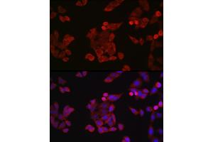 Immunofluorescence analysis of HeLa cells using Cyclin B1 Rabbit pAb (ABIN3022806, ABIN3022807, ABIN3022808 and ABIN6219237) at dilution of 1:150 (40x lens). (Cyclin B1 抗体  (C-Term))
