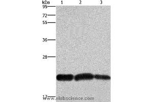 Western blot analysis of A375 and Raji cell, human fetal brain tissue, using CBX3 Polyclonal Antibody at dilution of 1:600 (CBX3 抗体)