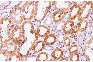Immunohistochemistry of paraffin-embedded Human kidney using Pck1 Polyclonal Antibody at dilution of 1:100 (PCK1 抗体)