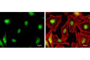 ICC/IF Image NR0B1 antibody detects NR0B1 protein at nucleus by immunofluorescent analysis. (NR0B1 抗体)
