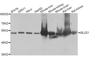 Western blot analysis of extracts of various cell lines, using GLUD1 antibody (ABIN5975614) at 1/1000 dilution. (GLUD1 抗体)