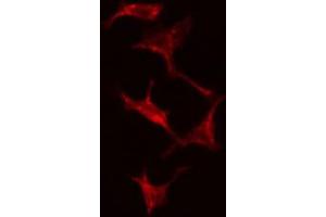 ABIN6274824 staining Hela cells by IF/ICC. (ADH7 抗体  (Internal Region))