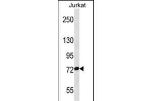 RP3 Antibody (Center) (ABIN1538291 and ABIN2849786) western blot analysis in Jurkat cell line lysates (35 μg/lane). (RPAP3 抗体  (AA 311-338))