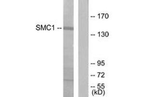 Western blot analysis of extracts from 293 cells, treated with UV 15', using SMC1 (Ab-957) Antibody. (SMC1A 抗体  (AA 931-980))