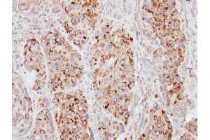 IHC-P Image Immunohistochemical analysis of paraffin-embedded A549 xenograft, using ECT2, antibody at 1:100 dilution. (ECT2 抗体  (N-Term))
