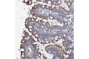 Immunohistochemical staining of human small intestine with PRHOXNB polyclonal antibody  shows moderate cytoplasmic positivity in glandular cells at 1:500-1:1000 dilution. (Ureidoimidazoline (2-Oxo-4-Hydroxy-4-Carboxy-5-) Decarboxylase (URAD) 抗体)