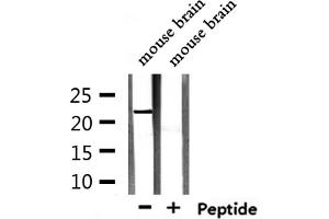 Western blot analysis of extracts from mouse brain, using TCEAL5 Antibody. (TCEAL5 抗体  (Internal Region))