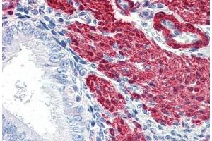 Immunohistochemistry (IHC) image for anti-Transgelin (TAGLN) (C-Term) antibody (ABIN185188)