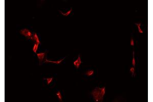 ABIN6266983 staining MCF-7 cells by IF/ICC. (MAST4 抗体  (N-Term))