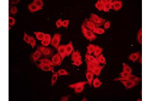 FHC cells probed with Rabbit Anti-RAC1(Ser71) Polyclonal Antibody Alexa Fluor Cy3 (RAC1 抗体  (pSer71))