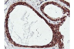 Immunohistochemical staining of paraffin-embedded Human breast tissue using anti-RNPEP mouse monoclonal antibody. (RNPEP 抗体)