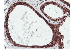 Immunohistochemical staining of paraffin-embedded Human breast tissue using anti-RNPEP mouse monoclonal antibody.