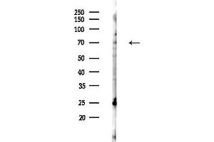 anti-Dynein, Axonemal, Intermediate Chain 2 (DNAI2) (N-Term) antibody