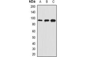Western blot analysis of AP180 expression in mouse brain (A), mouse eye (B), rat brain (C) whole cell lysates. (SNAP91 抗体)