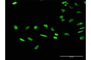 Immunofluorescence (IF) image for anti-General Transcription Factor IIE, Polypeptide 1, alpha 56kDa (GTF2E1) (AA 1-439) antibody (ABIN516260)