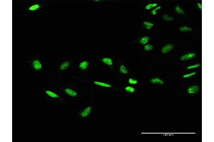 Immunofluorescence of purified MaxPab antibody to GTF2E1 on HeLa cell.