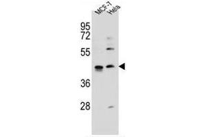 ZNF384 Antibody (C-term) western blot analysis in MCF-7, Hela cell line lysates (35 µg/lane). (ZNF384 抗体  (C-Term))