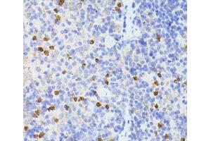 Immunohistochemistry of paraffin-embedded Mouse spleen using SMAD2 Polyclonal Antibody at dilution of 1:100 (40x lens). (SMAD2 抗体)