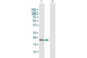 Western Blot analysis of SELS expression in transfected 293T cell line by SELS MaxPab polyclonal antibody. (Selenoprotein S 抗体  (AA 1-187))