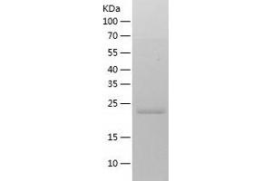 Western Blotting (WB) image for Carboxymethylenebutenolidase Homolog (CMBL) (AA 1-245) protein (His tag) (ABIN7122139) (CMBL Protein (AA 1-245) (His tag))