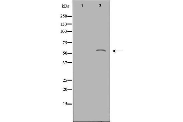 ACOT2 抗体  (Internal Region)