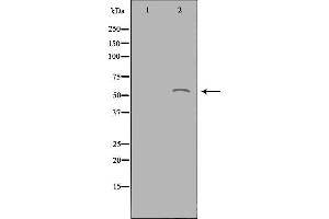 Western blot analysis of extracts from Jurkat cells using ACOT2 antibody. (ACOT2 抗体  (Internal Region))