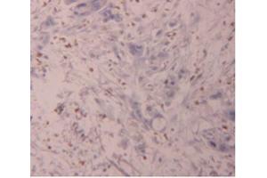 IHC-P analysis of Human Pancreas Tissue, with DAB staining. (FLG2 抗体  (AA 1222-1368))