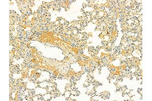 ABIN6262590 and ABIN6266579 at 1/100 staining Rat lung tissue by IHC-P. (NOS2 抗体  (C-Term))