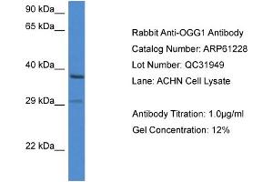 Western Blotting (WB) image for anti-8-Oxoguanine DNA Glycosylase (OGG1) (C-Term) antibody (ABIN2788728)