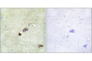 Immunohistochemistry analysis of paraffin-embedded human brain tissue, using TRIM59 Antibody. (TRIM59 抗体  (AA 191-240))