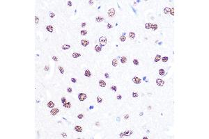 Immunohistochemistry (IHC) image for anti-Activating Transcription Factor 2 (ATF2) antibody (ABIN6137230)