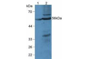 Western blot analysis of (1) Rat Liver Tissue and (2) Mouse Liver Tissue. (LPCAT3 抗体  (AA 122-233))