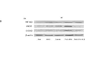 Expression of NF-κB, iNOS and COX-2 in response to Prdx6 siRNA and MJ33. (NOS2 抗体)