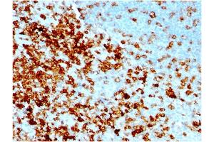 Formalin-fixed, paraffin-embedded human Tonsil stained with CD43 Mouse Recombinant Monoclonal Antibody (rSPN/1094). (Recombinant CD43 抗体)