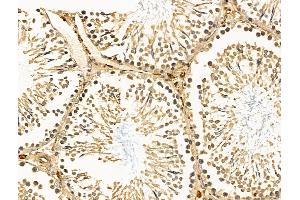 ABIN7094538 and ABIN7098587 at 1/100 staining Rat testis tissue by IHC-P.