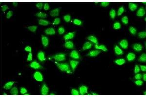 Immunofluorescence analysis of MCF-7 cells using PSMC3 Polyclonal Antibody (PSMC3 抗体)