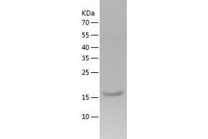 CHAC2 Protein (AA 1-184) (His tag)