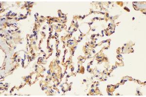 Immunohistochemistry of paraffin-embedded Human lung using PLAUR Ployclonal Antibody at dilution of 1:200. (PLAUR 抗体)