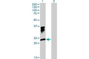 Western Blot analysis of ORM1 expression in transfected 293T cell line by ORM1 MaxPab polyclonal antibody. (ORM1 抗体  (AA 1-201))