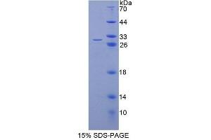 SDS-PAGE analysis of Human TCEA2 Protein. (TCEA2 蛋白)