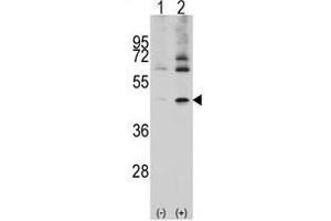 Image no. 2 for anti-Actin, Alpha, Cardiac Muscle 1 (ACTC1) (Center) antibody (ABIN357023) (ACTC1 抗体  (Center))