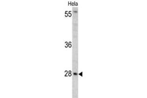 Western blot analysis of HPRT1 antibody (C-term) in Hela cell line lysates (35ug/lane). (HPRT1 抗体  (C-Term))